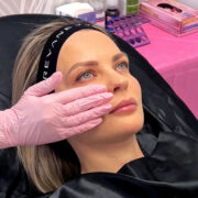 What Are Regenerative Skin Treatments and Who Are They For?